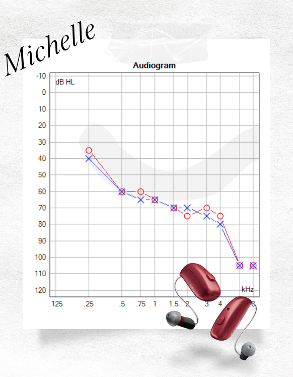 resound hearing aids michelle